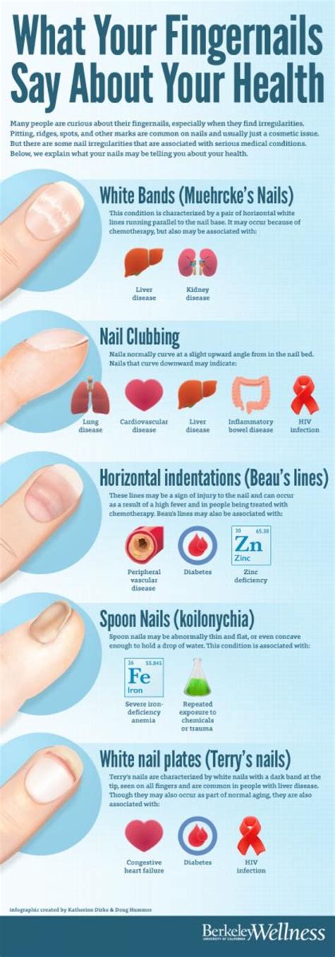 After Reading The Hazards And Adverse Effects Of Nail Biting You Will
