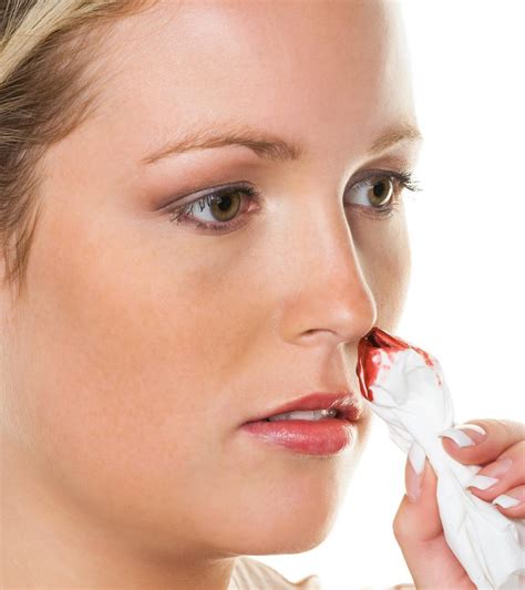 Nosebleeds In Teenagers Causes Treatment And Prevention
