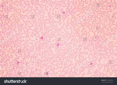 Human Blood Smear View Microscopycomplete Blood Stock Photo 716961862
