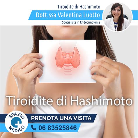 Tiroidite Di Hashimoto Specialista A Ostia Lido