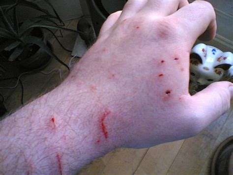 Things To Consider When A Cat Bitesscratches You Vetsupply