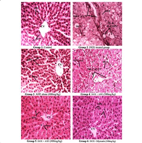 histopathological examination of rat liver hande staining magnification download scientific