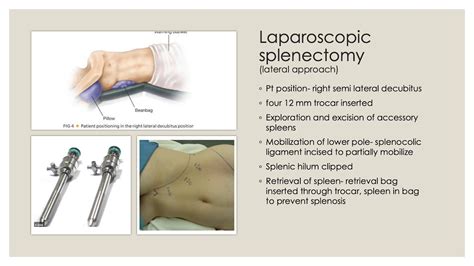 Splenectomy Specialty Presentation Youtube