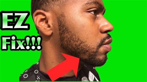Fix Beard Bald Spot Youtube