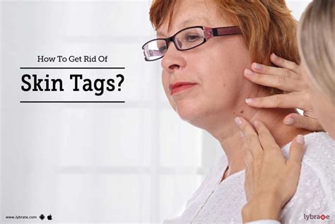 How To Get Rid Of Skin Tags By Dr Himanshu Singhal Lybrate