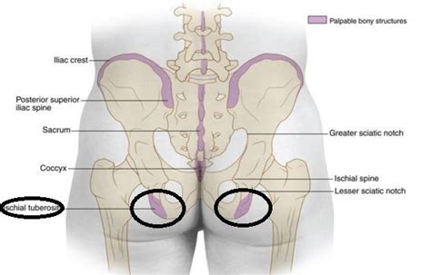 Ischial Tuberosity Surface Anatomy In Position To Human Body Bursitis