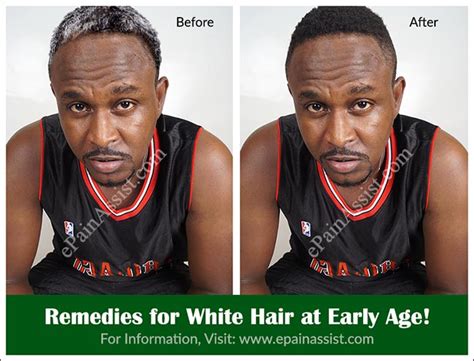 Quit smoking, stress less, keep junk foods for special occasions, eat more fruits. What Causes White Hair at Early Age & Remedies for It?