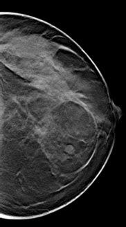 Breast Imaging Essential Physics