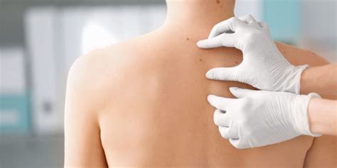 Learn More About Full Body Skin Exams Dermatology Associates Of