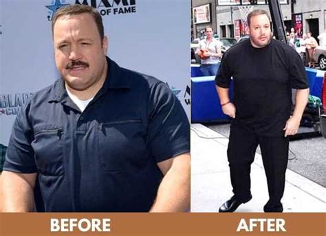 Kevin James Weight Loss 2024 Diet Surgery Before And After Photos