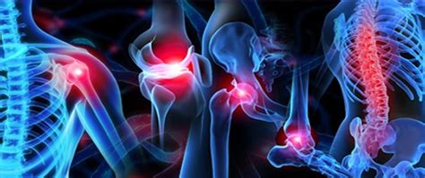 Blog All You Need To Know About Musculoskeletal Pain