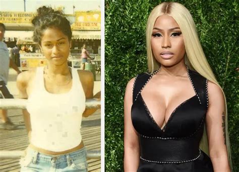 nicki minaj s before surgery and after pictures