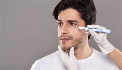 Handsome Male Face With Black Marks On Skin Under Eye Stock Photo