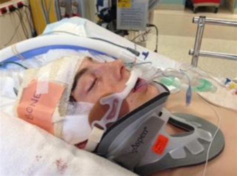 Teenager In An Induced Coma After He Was Punched In The Head Daily