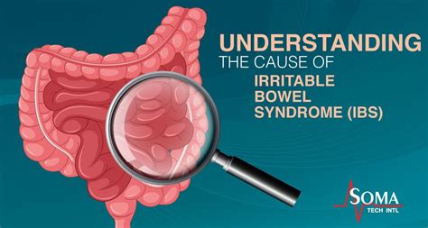 Understanding The Cause Of Irritable Bowel Syndrome Ibs Tw Mcisaac
