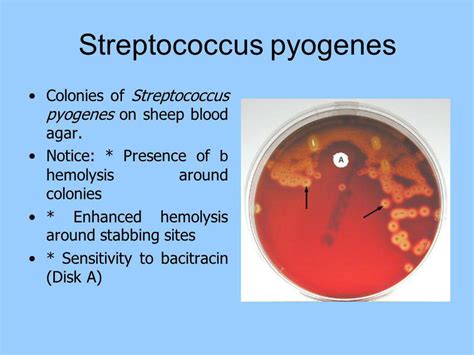 Antibiotics For Strep Pyogenes