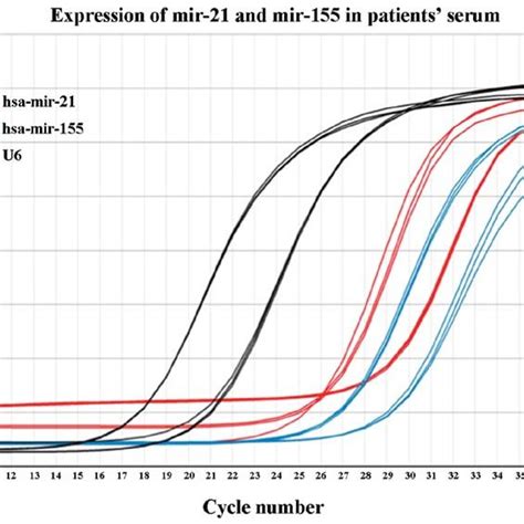 ROC Analysis Curve Of CEA CA 125 And MiR 155 Expression In The Serum