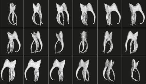 Volume Rendered Images Of The Dental Pulp From Figure 3 In 18 Different