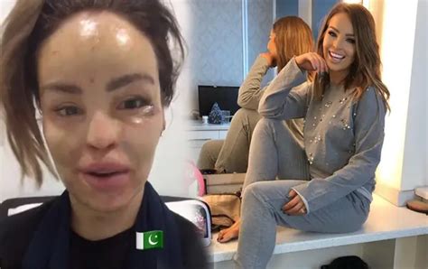 Katie Piper Recovering After Secret Surgery In Pakistan Heart
