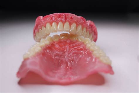 Dentadura Completa 2 Protésico Dental Arte Dental Ortodoncia