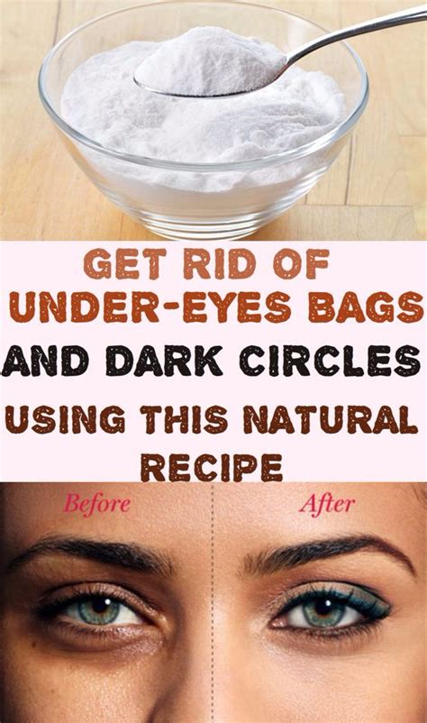 Get Rid Of Under Eyes Bags And Dark Circles Using This Natural Recipe