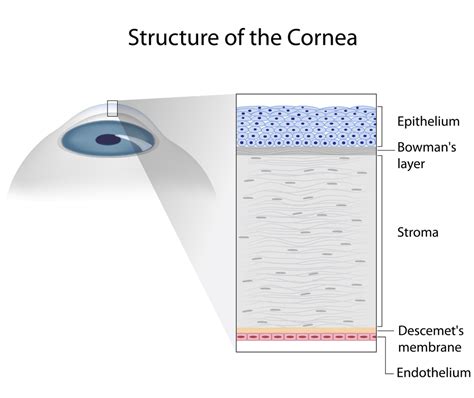 Cataract Surgery And Keratoconus Discovery Eye Foundation