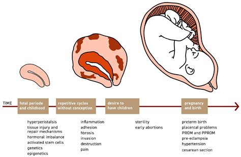 JCM Free Full Text Deep Infiltrating Endometriosis And Adenomyosis