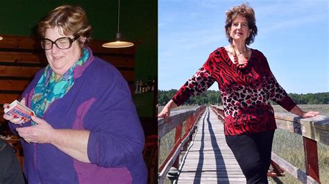 Bluffton Woman Reads Weight Loss Book And Loses 172 Pounds Hilton Head Island Packet