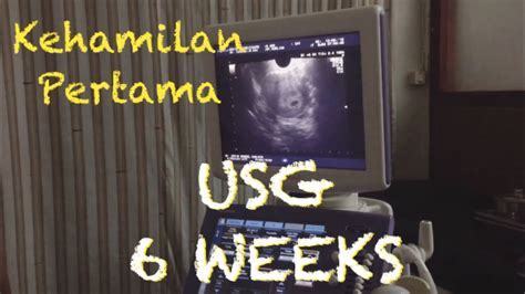 Mual dan muntah (morning sickness). Kehamilan Pertama - USG 6 Minggu (1 Bulan di Diagnosa ...