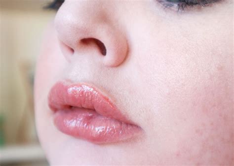 Whats It Like To Get Juvederm Lip Fillers A Life With Frills
