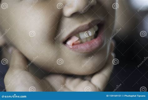Close Up Of Boy Mouth Biting The Gauze In Mouth After Tooth Extraction