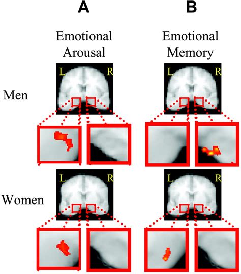 Sex Differences In The Neural Basis Of Emotional Memories Pnas