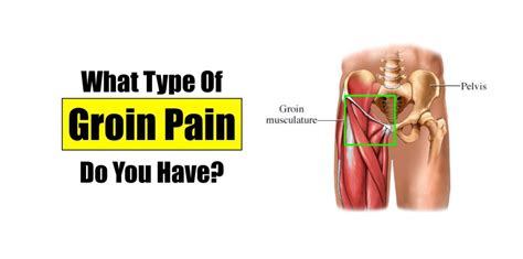 What Kind Of Groin Pain Do You Have Squat University