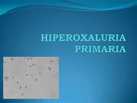 Hiperoxaluria Primaria Ppt