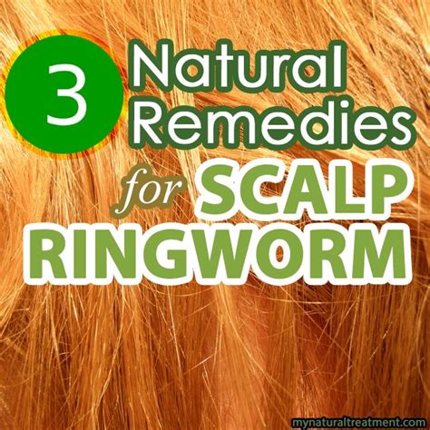 Here You Have The Most Amazing Natural Remedies For Scalp Ringworm