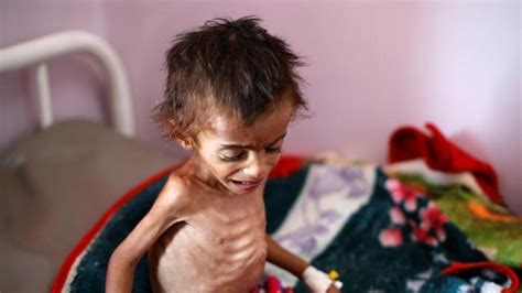 14 مليون شخص على شفا المجاعة خلال الأشهر القليلة المقبلة في اليمن