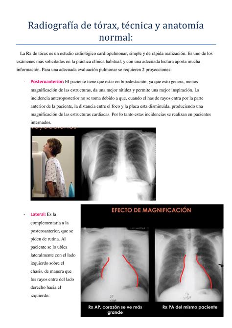 Teorico Imagenes Torax Radiografí a de to rax te cnica y anatomí a