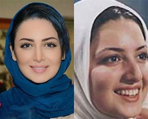 عکس بازیگران زن ایرانی قبل و بعد از عمل زیبایی توضیحات سایت تفریحی و سرگرمی نازشو