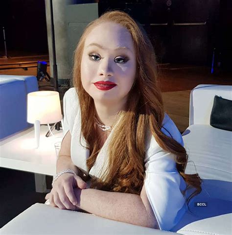 Meet Madeline Stuart Worlds 1st Supermodel With Down Syndrome Photogallery Etimes