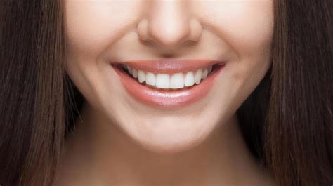 5 Ways to Have a Perfect Smile | Vista Dental Care