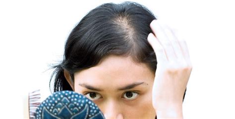 Receding hairlines can also be symptoms of certain types of cancers, infectious diseases, autoimmune disorders, eating disorders, mental health issues, thyroid disorders, medications, and the use of anabolic steroids. How to Stop Receding Hairline: Different Methods