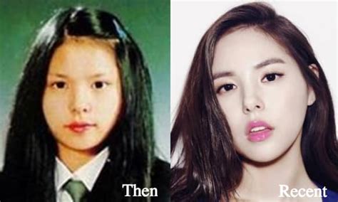 Min Hyo Rin Before And After Plastic Surgery