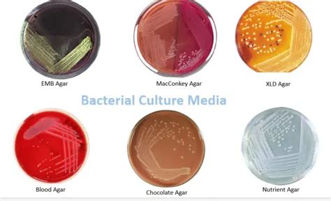 Bacterial Culture Media Classification Types Uses Microbe Online