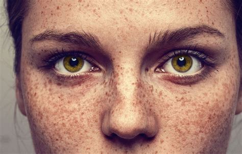 What All Women With Freckles Need To Know Womens Health