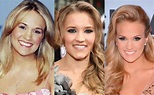 Carrie Underwood Plastic Surgery Before and After Pictures 2024