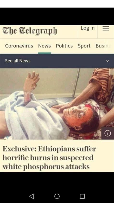 Ethiopians Suffer Horrific Burns In Suspected White Phosphorus Attacks