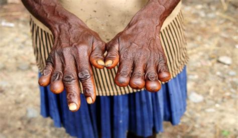 the beyond belief finger cutting ritual dani tribe indonesia