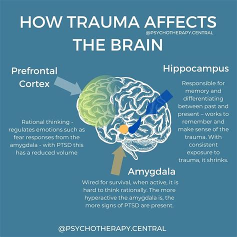 How Trauma Affects The Brain Artofit