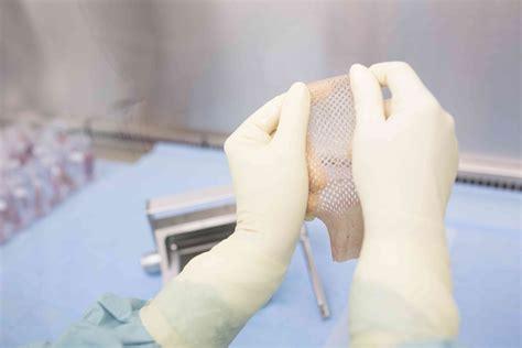 Integra Skin Graft Uses Side Effects Procedure Results