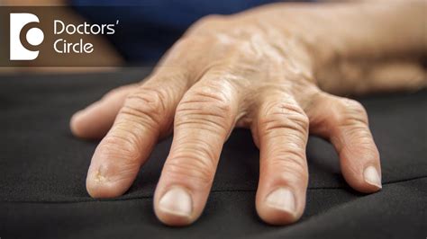 What Are Signs And Symptoms Of Rheumatoid Arthritis Dr Yathish G C